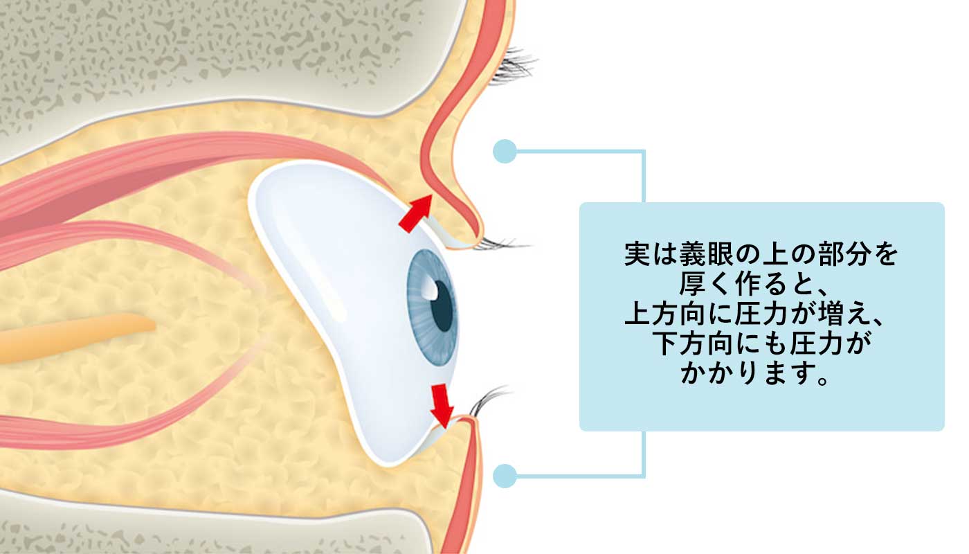 義眼